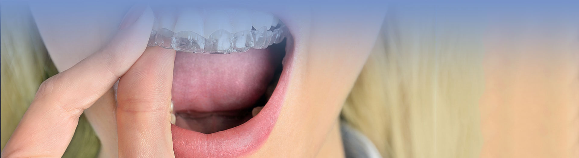 Woman putting mouth guard on teeth