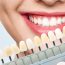 Imperfect Teeth? Transform your Smile with Dental Veneers