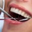 Restore the Health and Appearance of Your Smile with Full Mouth Rehabilitation